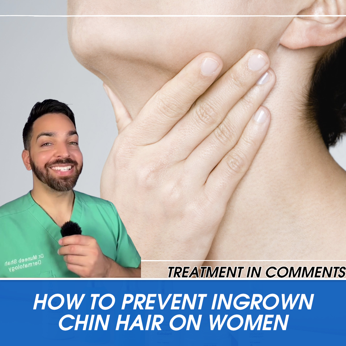 How to Prevent Ingrown Chin Hair on Women
