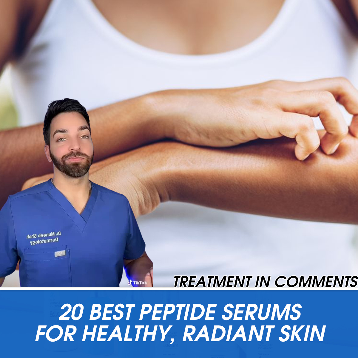 16 Best Ways to Stop Bug Bites From Itching, According to Doctors