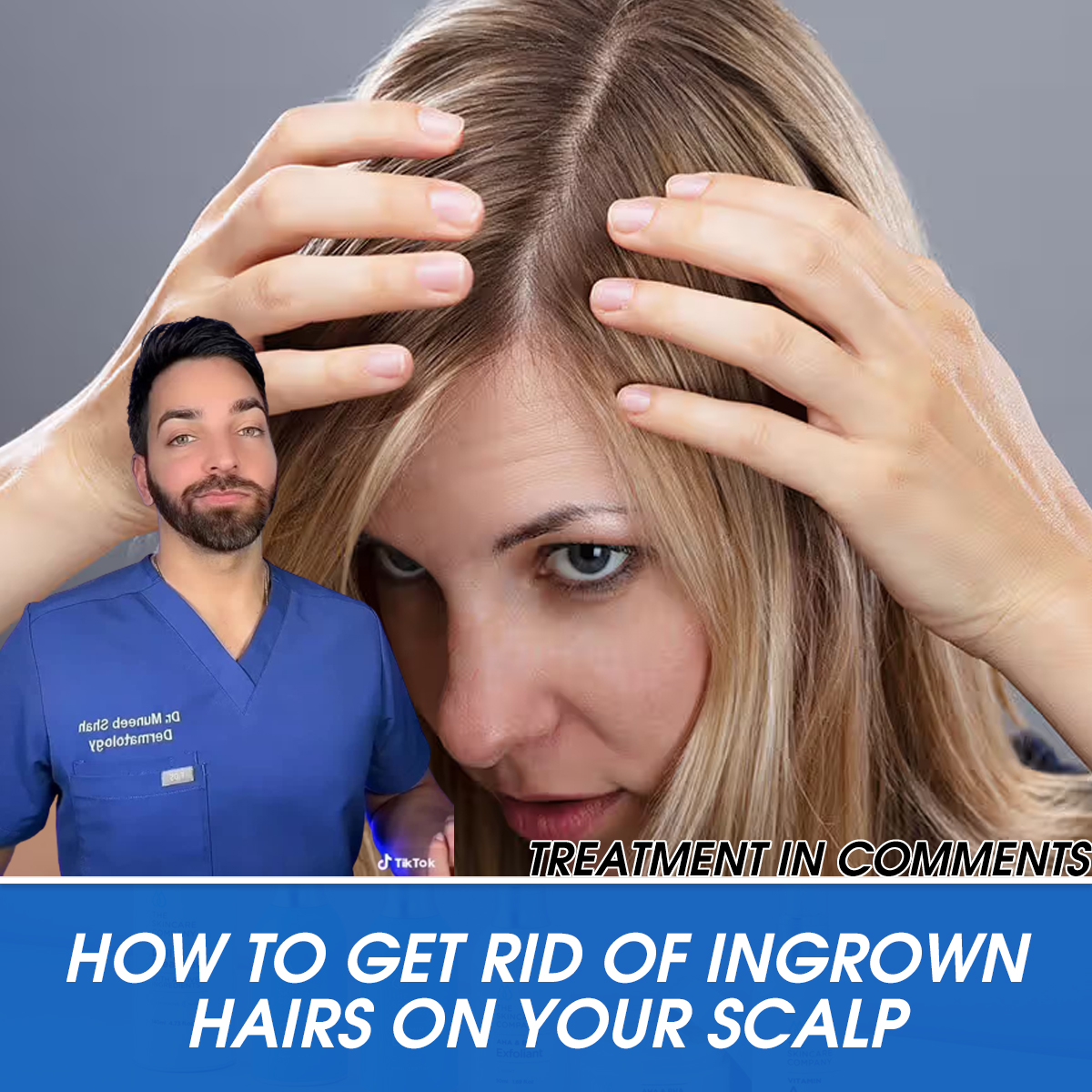 How to Get Rid of Ingrown Hairs on Your Scalp, According to Dermatologists