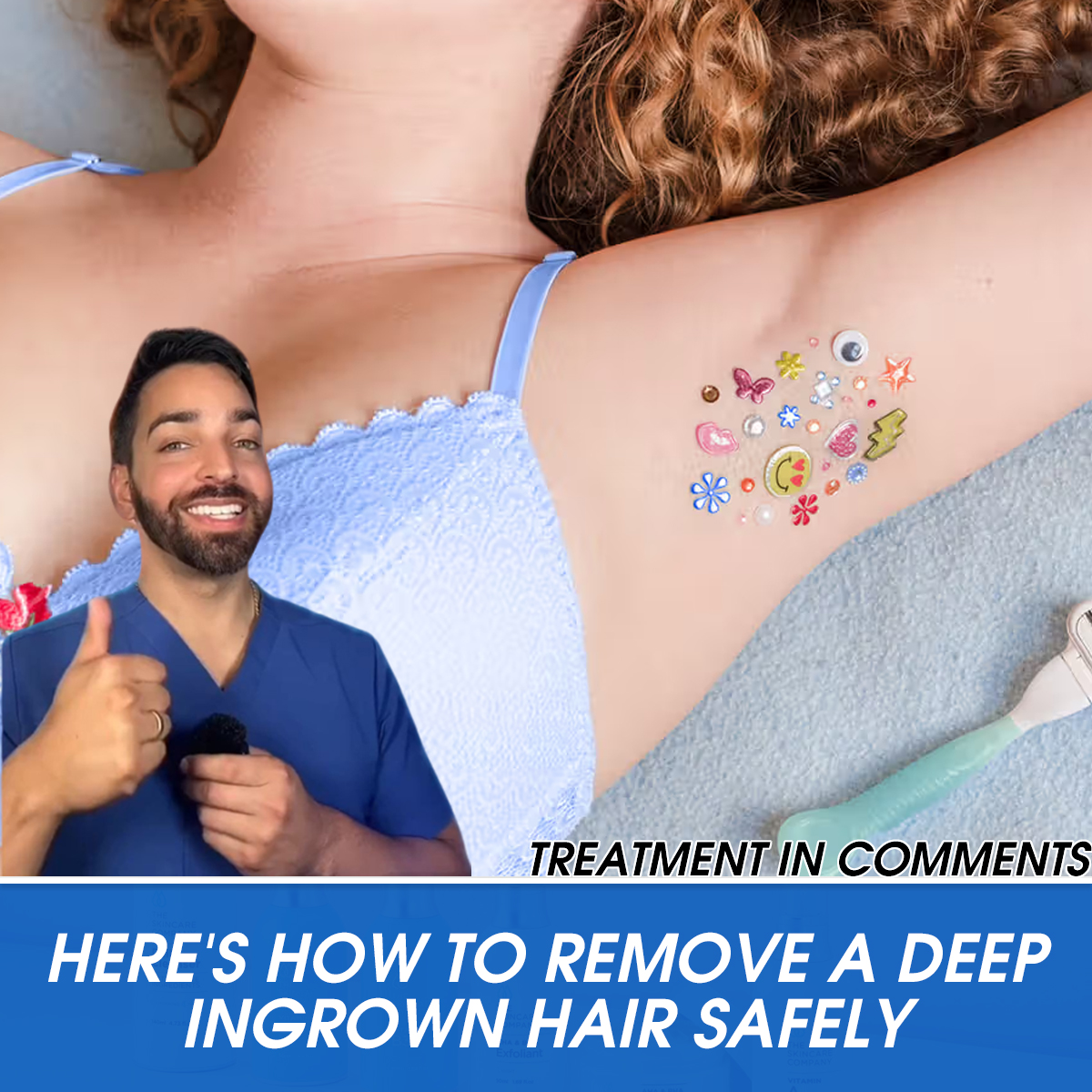 Here’s How to Remove a Deep Ingrown Hair Safely, According to Derms
