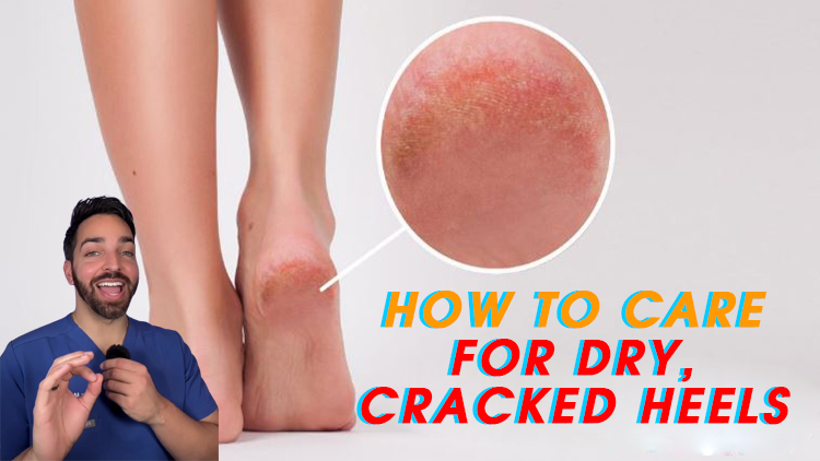 How to Care for Dry, Cracked Heels